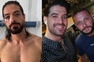 Γλυφάδα: Επιχειρηματίας κατήγγειλε ξυλοδαρμό από πρώην συνέταιρό του μέσα σε εστιατόριο